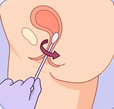 Inserting the swab about 5 cm and rotating 5 times